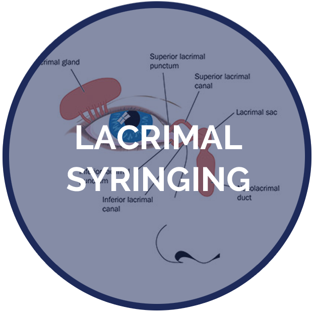 Services Pages Lacrimal Syringin